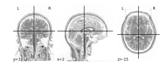 Nilearn image math example output