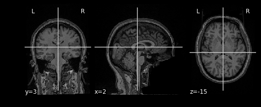 Nilearn antomical plotting
